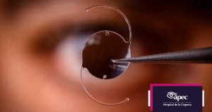 lentes-intraoculares-apec-hospital-ceguera-presbicia-vista-cansada-lentes-ilos-cirugia-refractiva-cataratas